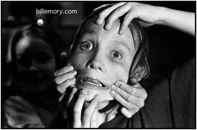 they stretch your skin